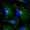 Transferrin Receptor antibody, NBP1-85741, Novus Biologicals, Immunofluorescence image 