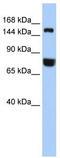Early Endosome Antigen 1 antibody, TA344446, Origene, Western Blot image 
