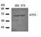 Activating Transcription Factor 2 antibody, orb14444, Biorbyt, Western Blot image 