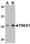 Three Prime Repair Exonuclease 1 antibody, TA306702, Origene, Western Blot image 