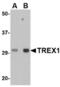 Three Prime Repair Exonuclease 1 antibody, TA306702, Origene, Western Blot image 