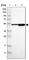 SRY-Box 30 antibody, HPA006159, Atlas Antibodies, Western Blot image 