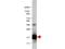 Interleukin 36 Receptor Antagonist antibody, NBP1-77873, Novus Biologicals, Western Blot image 