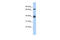 GATA Binding Protein 6 antibody, 25-032, ProSci, Western Blot image 