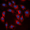 Ribosomal Protein S6 Kinase B1 antibody, LS-C368518, Lifespan Biosciences, Immunofluorescence image 