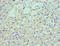 Low Density Lipoprotein Receptor Adaptor Protein 1 antibody, LS-C377809, Lifespan Biosciences, Immunohistochemistry paraffin image 