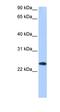 Egl-9 Family Hypoxia Inducible Factor 3 antibody, orb330684, Biorbyt, Western Blot image 
