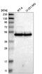 TWIST Neighbor antibody, HPA019071, Atlas Antibodies, Western Blot image 