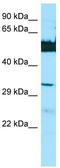 Lengsin, Lens Protein With Glutamine Synthetase Domain antibody, TA338047, Origene, Western Blot image 