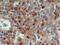 CD69 Molecule antibody, NBP2-25236, Novus Biologicals, Immunohistochemistry paraffin image 