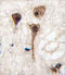 Myocyte-specific enhancer factor 2C antibody, abx032782, Abbexa, Immunohistochemistry paraffin image 