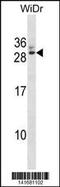 General Transcription Factor IIF Subunit 2 antibody, 60-908, ProSci, Western Blot image 