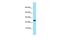 Interleukin 19 antibody, GTX16316, GeneTex, Western Blot image 