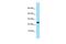 Interleukin 19 antibody, GTX16316, GeneTex, Western Blot image 