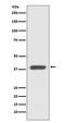 Atypical Chemokine Receptor 3 antibody, M02656, Boster Biological Technology, Western Blot image 