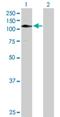 Zinc Finger Protein 484 antibody, H00083744-B01P, Novus Biologicals, Western Blot image 