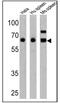 Eukaryotic Translation Initiation Factor 2 Alpha Kinase 2 antibody, PA1-991, Invitrogen Antibodies, Western Blot image 