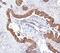 Mechanistic Target Of Rapamycin Kinase antibody, A00003-2, Boster Biological Technology, Immunohistochemistry paraffin image 