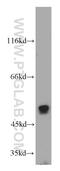 Cyclin Dependent Kinase 14 antibody, 21612-1-AP, Proteintech Group, Western Blot image 