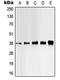 Casein Kinase 1 Alpha 1 antibody, orb213787, Biorbyt, Western Blot image 