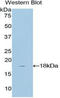 TATA-Box Binding Protein Associated Factor 13 antibody, LS-C296577, Lifespan Biosciences, Western Blot image 