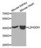 L-2-Hydroxyglutarate Dehydrogenase antibody, STJ110303, St John