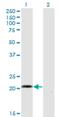 Cellular Communication Network Factor 5 antibody, H00008839-M02, Novus Biologicals, Western Blot image 