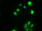 Checkpoint Kinase 2 antibody, LS-C114504, Lifespan Biosciences, Immunofluorescence image 