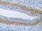 Zinc Finger MYND-Type Containing 11 antibody, CSB-PA947569, Cusabio, Immunohistochemistry paraffin image 