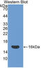 CD160 antigen antibody, MBS2013665, MyBioSource, Western Blot image 