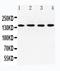 Inositol Polyphosphate Phosphatase Like 1 antibody, PA1750, Boster Biological Technology, Western Blot image 