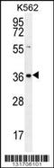 Solute Carrier Family 25 Member 31 antibody, TA324461, Origene, Western Blot image 