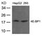 Eukaryotic Translation Initiation Factor 4E Binding Protein 1 antibody, 79-367, ProSci, Western Blot image 