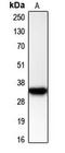 Cyclin Dependent Kinase 2 antibody, MBS821984, MyBioSource, Western Blot image 