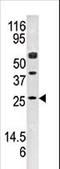 Adenylate Kinase 4 antibody, LS-C101252, Lifespan Biosciences, Western Blot image 