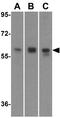 Receptor Interacting Serine/Threonine Kinase 2 antibody, GTX31644, GeneTex, Western Blot image 