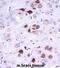 Megakaryocyte-Associated Tyrosine Kinase antibody, abx027927, Abbexa, Immunohistochemistry paraffin image 