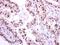 NIMA Related Kinase 2 antibody, GTX118735, GeneTex, Immunohistochemistry paraffin image 