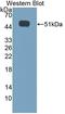 Calcium Voltage-Gated Channel Subunit Alpha1 H antibody, LS-C373339, Lifespan Biosciences, Western Blot image 