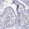 Stimulated by retinoic acid gene 6 protein antibody, NBP1-83719, Novus Biologicals, Immunohistochemistry paraffin image 