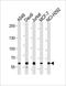 Complement C3b/C4b Receptor 1 (Knops Blood Group) antibody, orb308735, Biorbyt, Western Blot image 