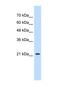 Progesterone Receptor Membrane Component 1 antibody, NBP1-59827, Novus Biologicals, Western Blot image 