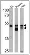 Arrestin Beta 2 antibody, PA1-730, Invitrogen Antibodies, Western Blot image 