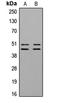 Vasodilator Stimulated Phosphoprotein antibody, LS-C354117, Lifespan Biosciences, Western Blot image 