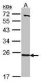 Heme-binding protein 1 antibody, GTX116121, GeneTex, Western Blot image 