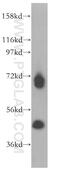 RNA Binding Motif Protein 17 antibody, 13918-1-AP, Proteintech Group, Western Blot image 