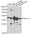 Alcohol dehydrogenase [NADP+] antibody, A13577, ABclonal Technology, Western Blot image 