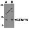 Centromere Protein W antibody, 6943, ProSci, Western Blot image 
