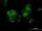 Myocyte Enhancer Factor 2A antibody, H00004205-M15, Novus Biologicals, Immunofluorescence image 