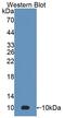 S100 Calcium Binding Protein A7 antibody, LS-C297869, Lifespan Biosciences, Western Blot image 